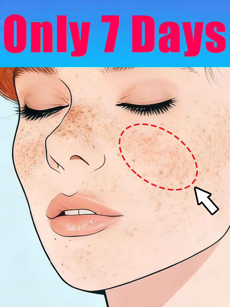 Lightening Facial Freckles Mel - đánh giá và giá Luxury Natural Skincare
